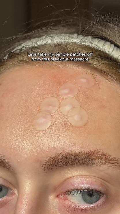 Acne Patch